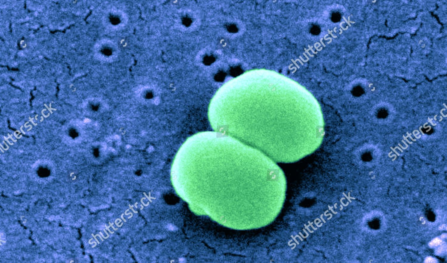 Staphylococcus Epidermidis Sem Editorial Stock Photo Stock Image