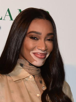 Winnie Harlow Editorial Stock Photo - Stock Image | Shutterstock