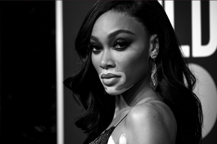 Winnie Harlow Editorial Stock Photo - Stock Image | Shutterstock