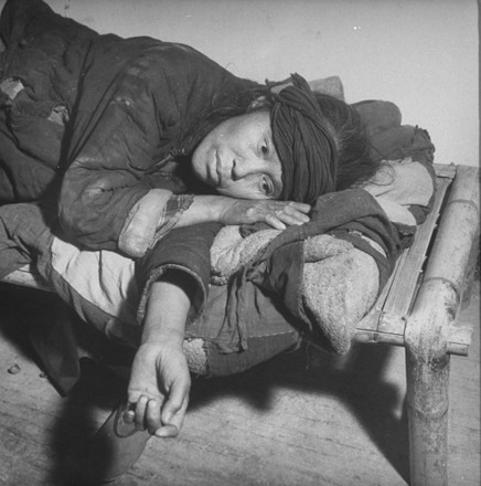 December 1945 Severely Malnourished Man One Editorial Stock Photo ...