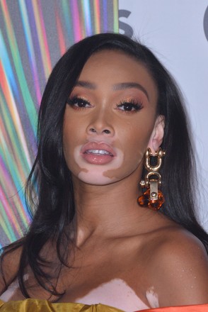 Winnie Harlow Editorial Stock Photo - Stock Image | Shutterstock