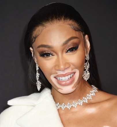 Winnie Harlow Editorial Stock Photo - Stock Image | Shutterstock