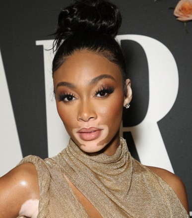 Winnie Harlow Editorial Stock Photo - Stock Image | Shutterstock