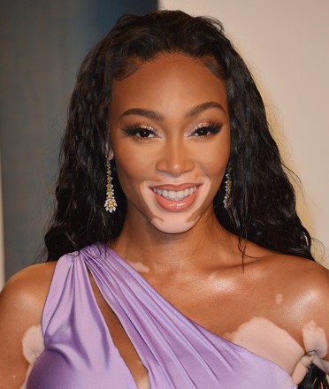 Winnie Harlow Editorial Stock Photo - Stock Image | Shutterstock