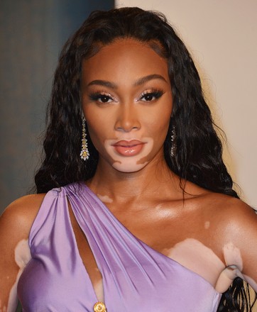 Winnie Harlow Editorial Stock Photo - Stock Image | Shutterstock
