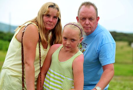 10-year-old girl gets sunburned after school refuses to apply sun cream on her in Swansea, Wales, Britain - 12 Jul 2011