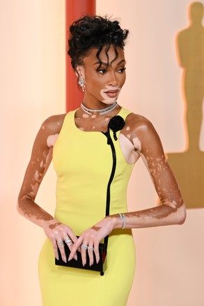 Winnie Harlow Editorial Stock Photo - Stock Image | Shutterstock