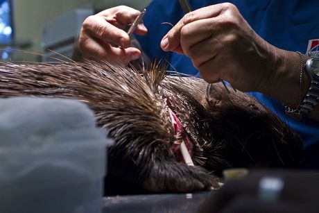 VIDEO: Wound Healing Might Be Improved With Staples Modeled On Porcupine  Quills : Shots - Health News : NPR