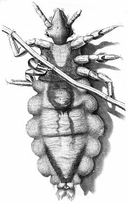 Human Louse Wingless Parasitic Insect Engraving Editorial Stock Photo
