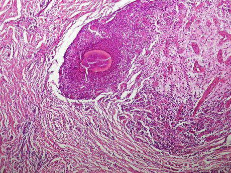 63 Microscopic image Stock Pictures, Editorial Images and Stock Photos ...