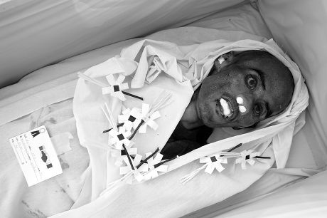 Unclaimed Body Aids Victim Lies Sweating Editorial Stock Photo - Stock ...