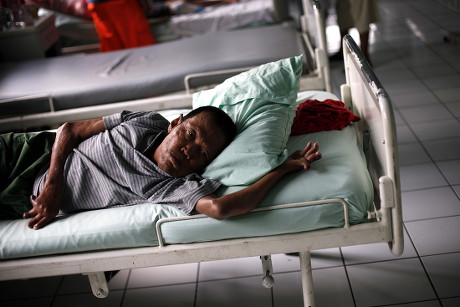 Indonesian Leprosy Sufferer Abdul Amin 42 Editorial Stock Photo - Stock ...