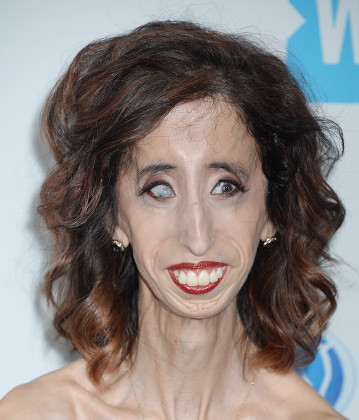 Lizzie Velasquez Editorial Stock Photo - Stock Image | Shutterstock