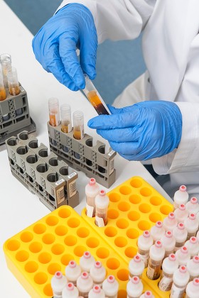 Preparation Blood Samples Examination Fully Automatic Editorial Stock ...
