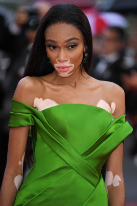 Winnie Harlow Editorial Stock Photo - Stock Image | Shutterstock