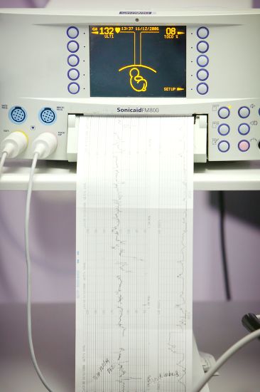 Computerised Ecg Machine Monitering Babys Heart Editorial Stock Photo ...