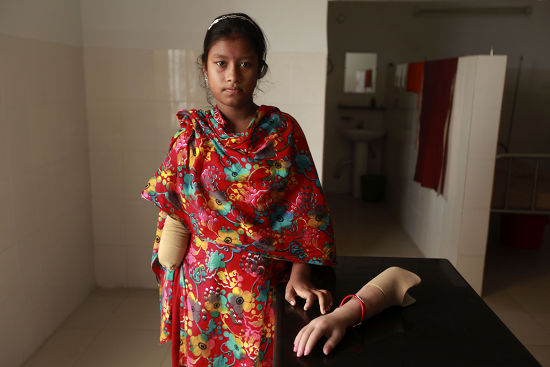 Anna Survivor Rana Plaza Building Collapse Editorial Stock Photo