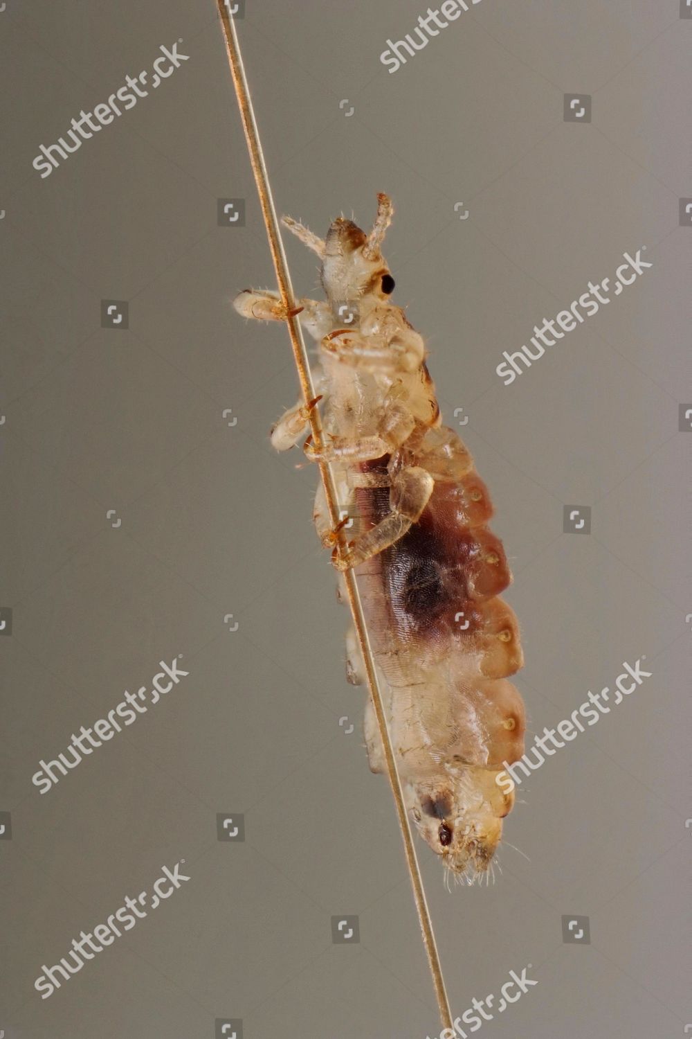 Head Louse Pediculus Humanus Capitis On Editorial Stock Photo Stock