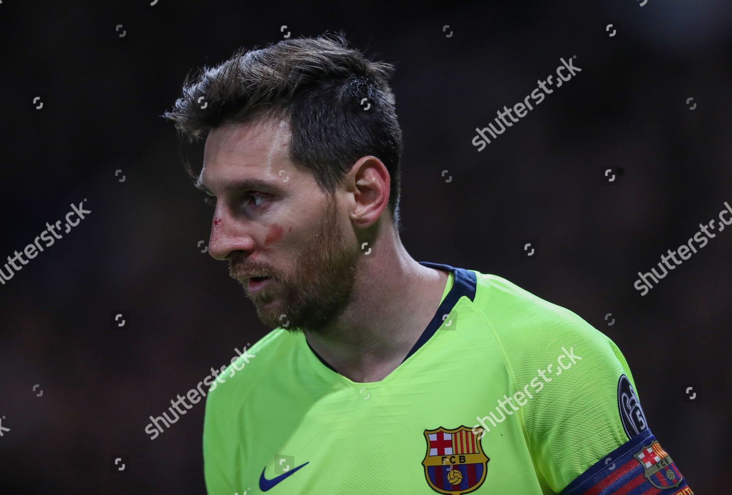 Lionel Messi Barcelona Blood On His Nose Editorial Stock Photo