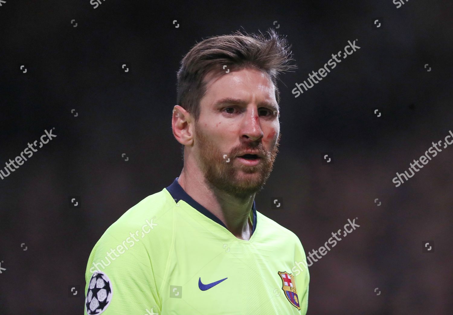 Lionel Messi Barcelona Blood On His Nose Editorial Stock Photo