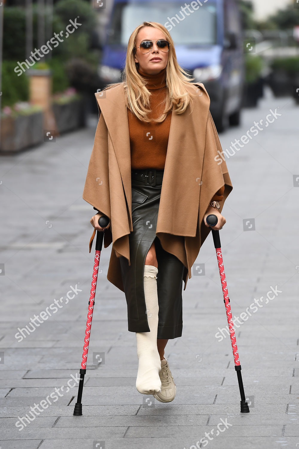 Amanda Holden Cast On Her Leg Editorial Stock Photo - Stock Image 