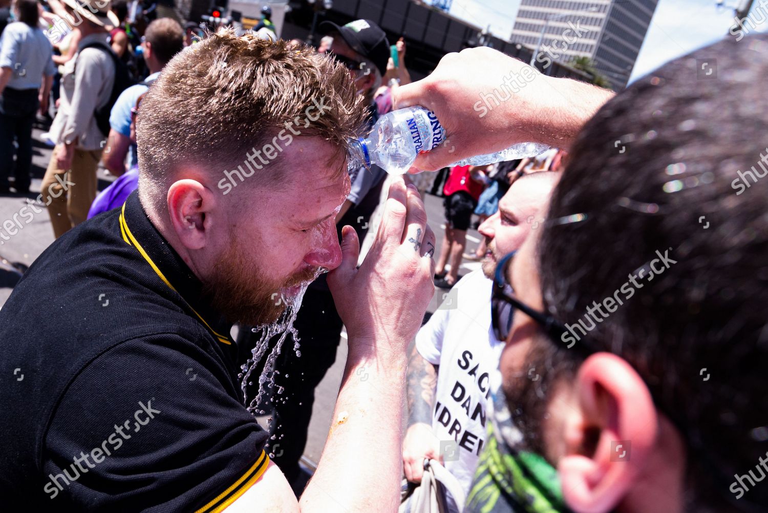 Demonstrator Seen Getting His Eyes Flushed Editorial Stock Photo