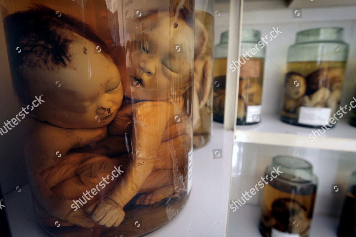 Dozens Foetuses Deformed Babies Preserved Formaldehyde Tu Editorial Stock Photo Stock Image Shutterstock