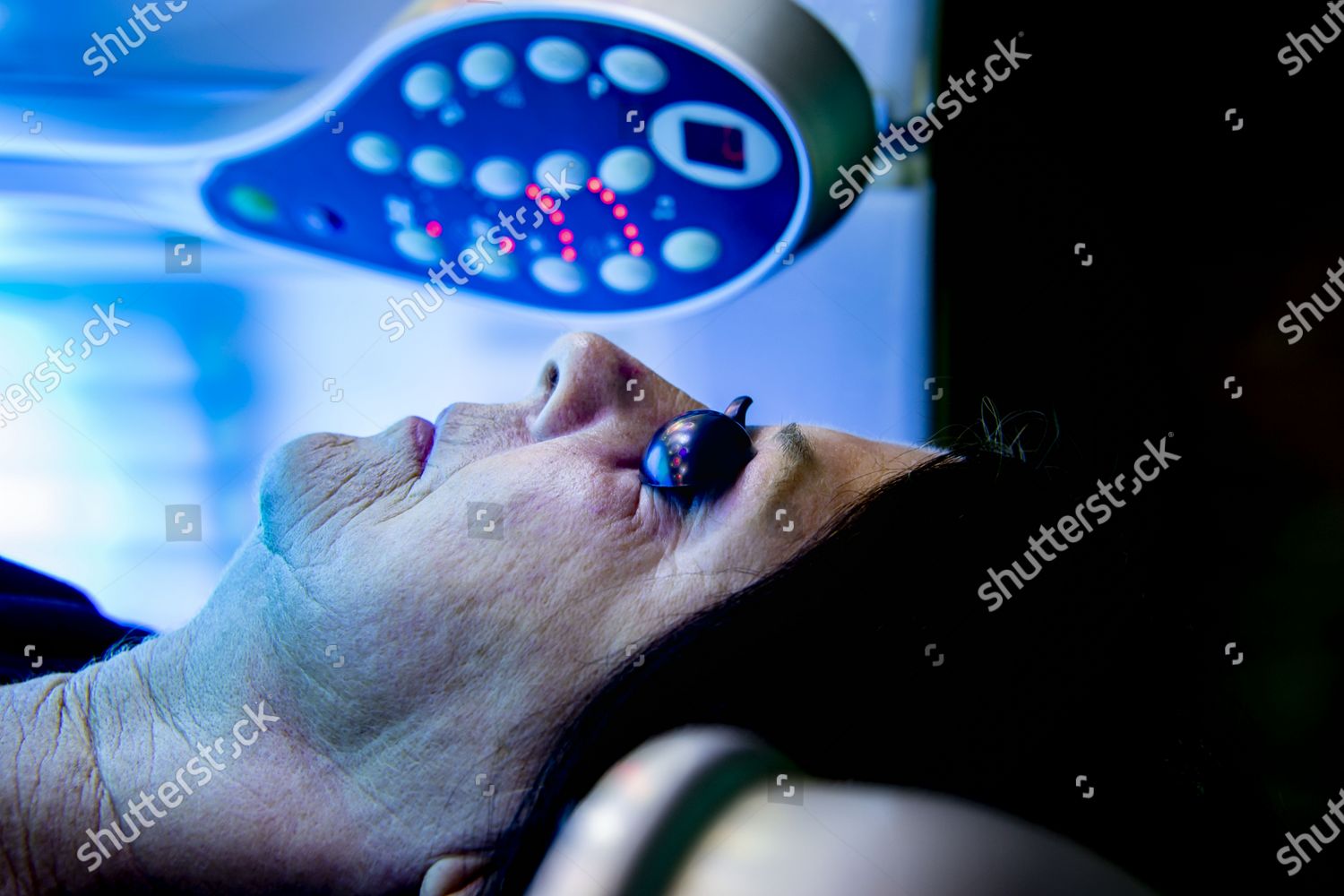 Sunbed Has Been Open Again Today Editorial Stock Photo Stock Image