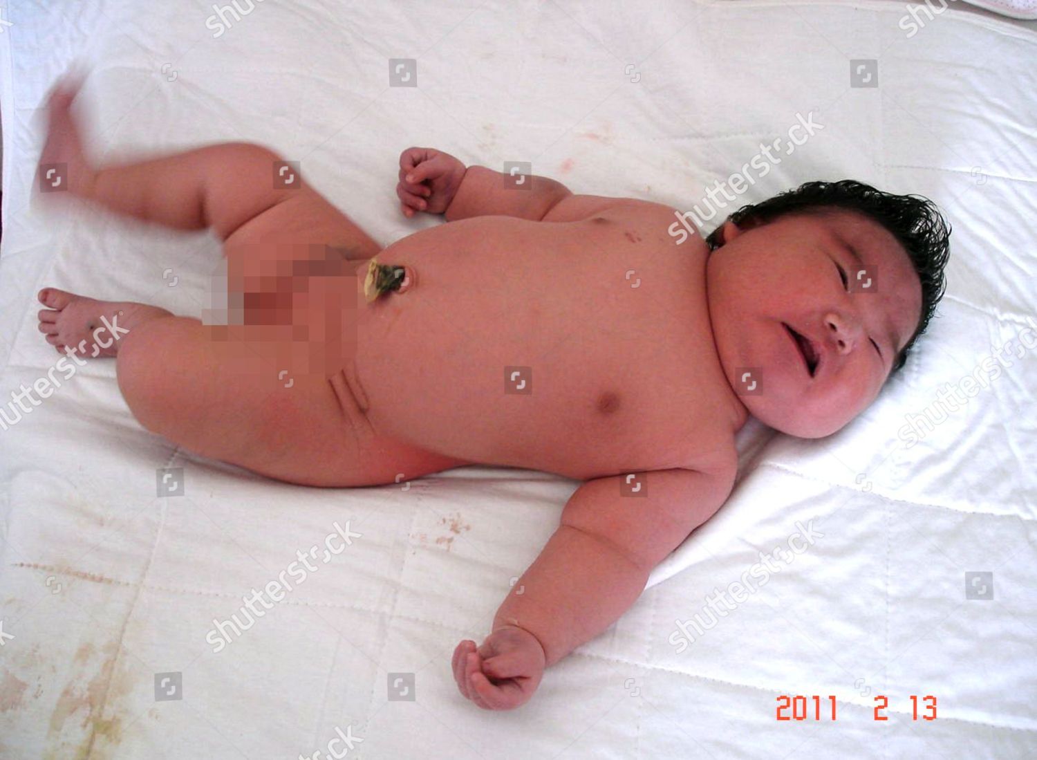 Newborn Baby Girl Who Weighs 68 Kg Editorial Stock Photo Stock Image Shutterstock