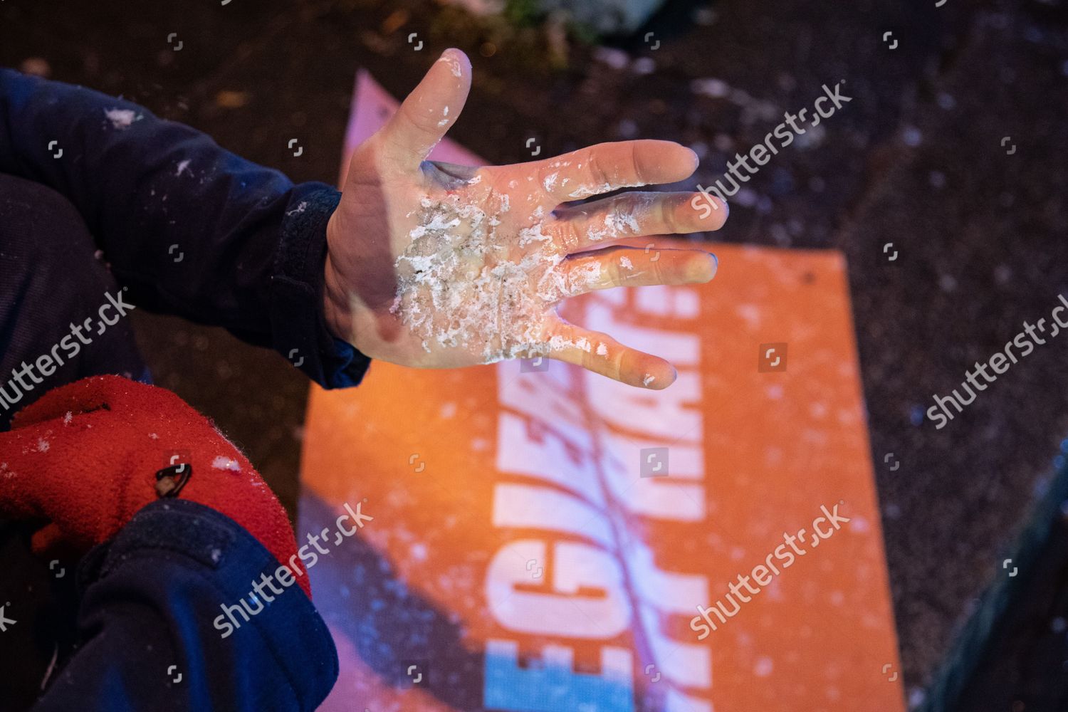 Injured Hand That Ripped Road While Editorial Stock Photo - Stock Image ...