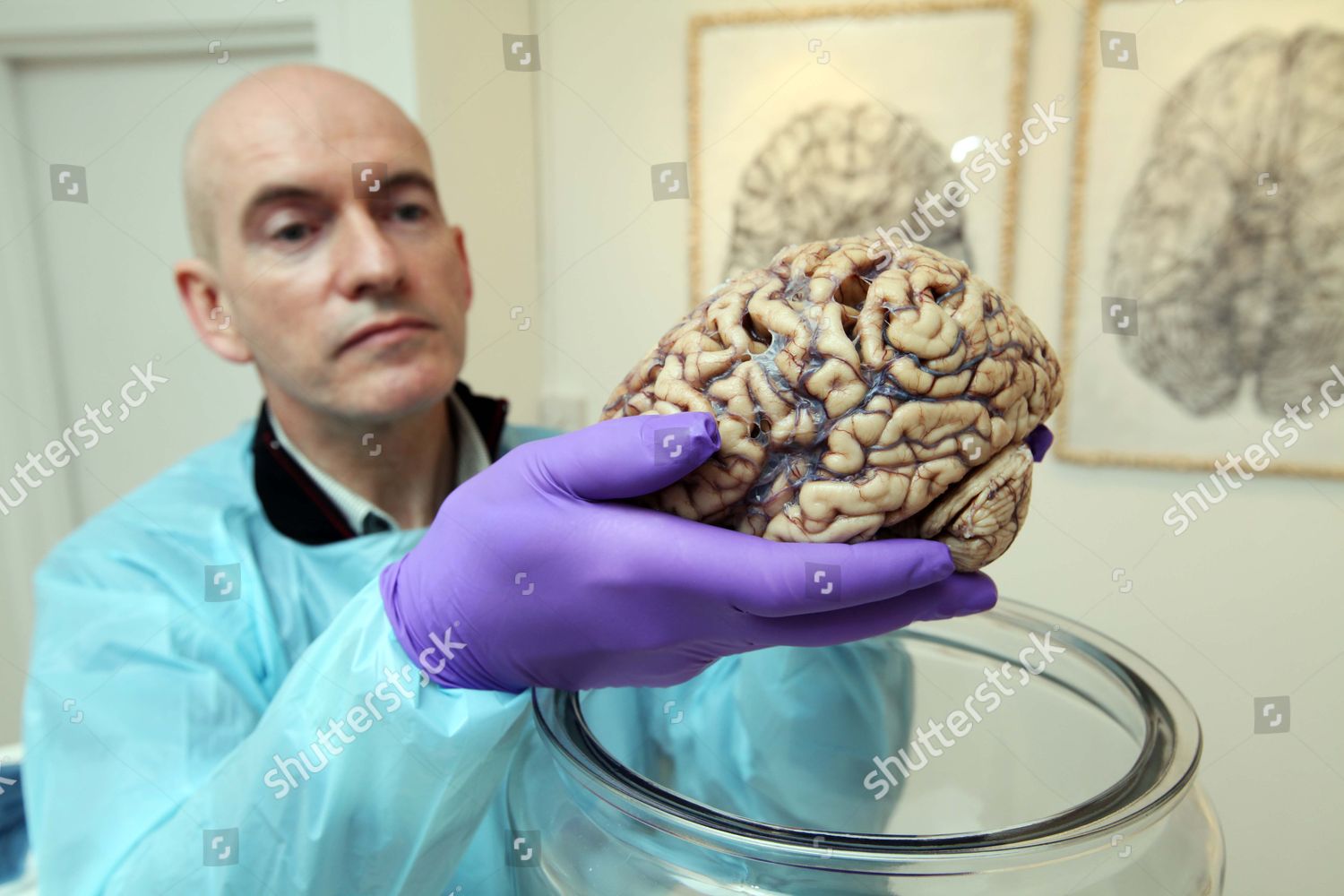 Brain 106. Натовщий мозг человека. Настоящий человеческий мозг.