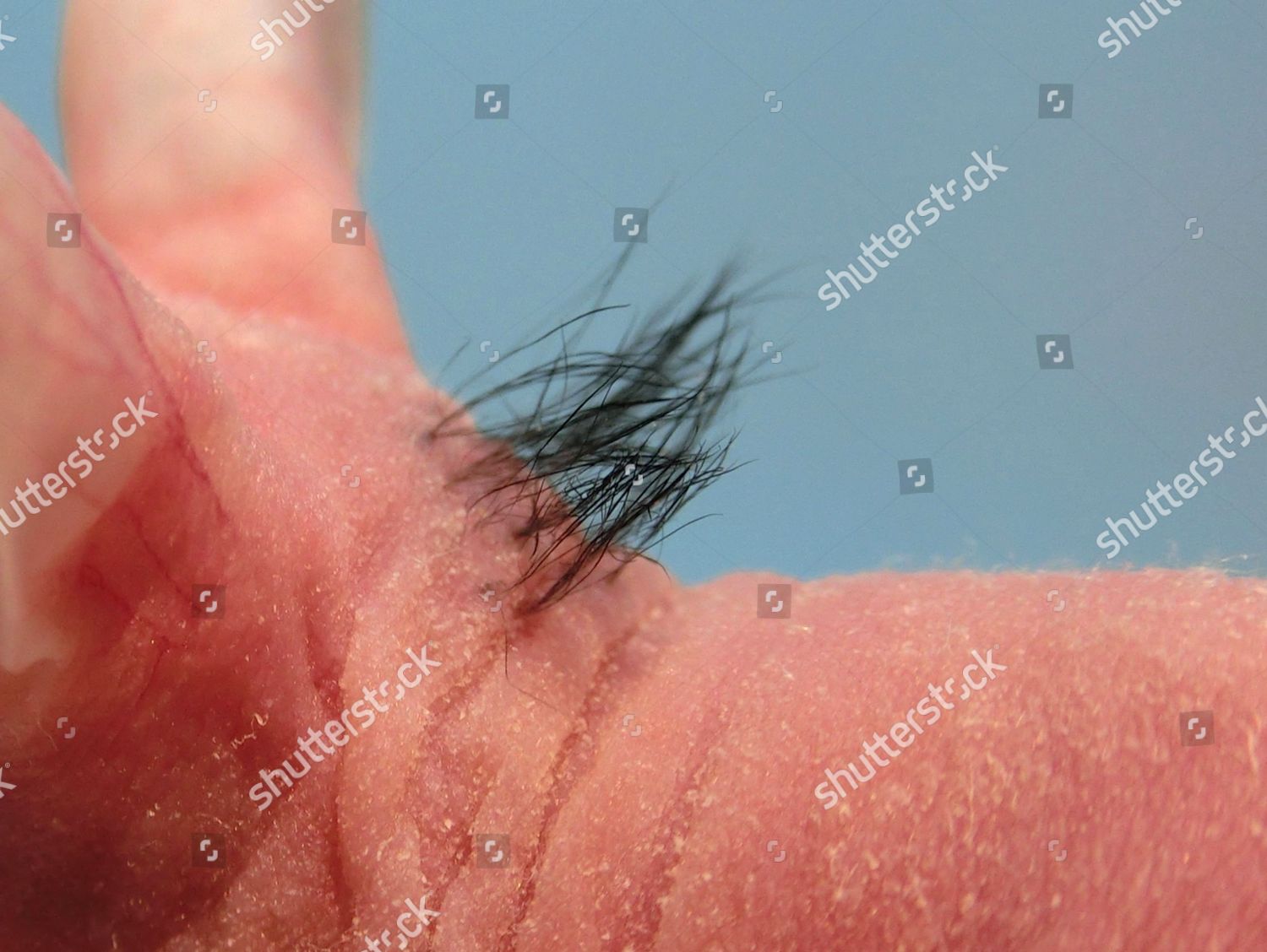 test-mouse-patch-hair-on-back-editorial-stock-photo-stock-image