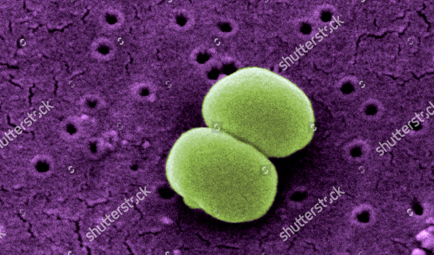 Staphylococcus epidermidis фото