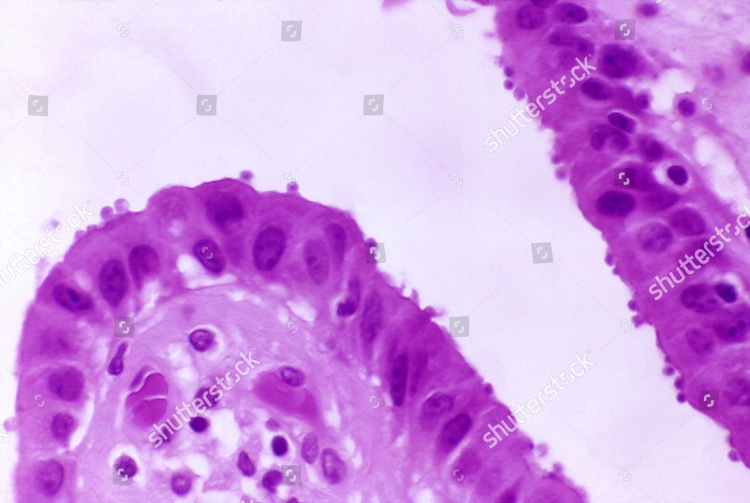 cryptosporidiosis-editorial-stock-photo-stock-image-shutterstock