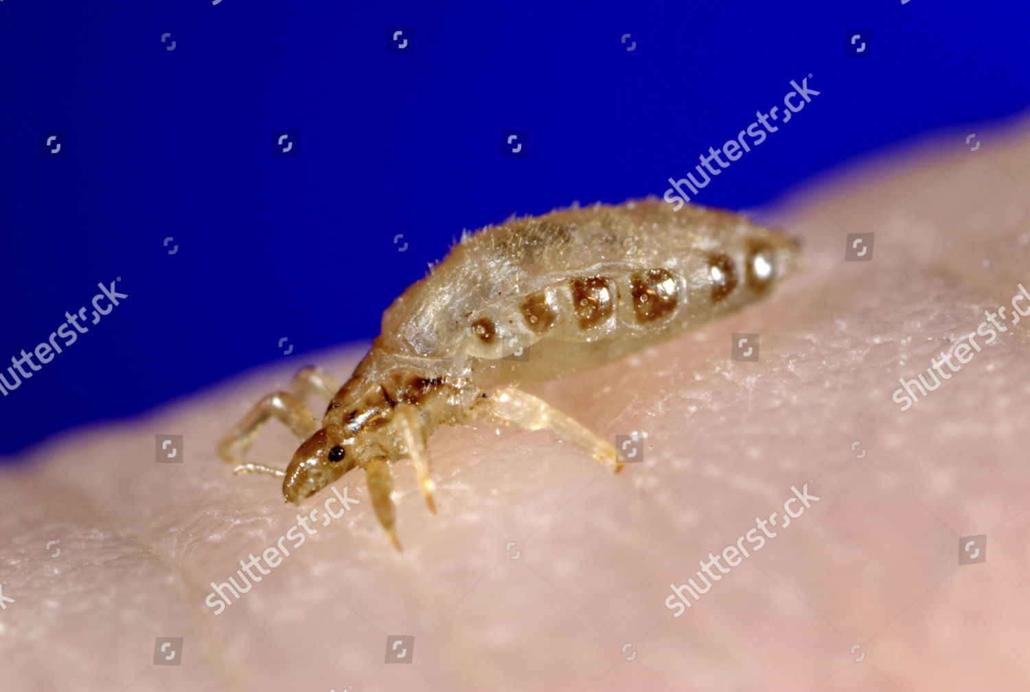 body-louse-editorial-stock-photo-stock-image-shutterstock