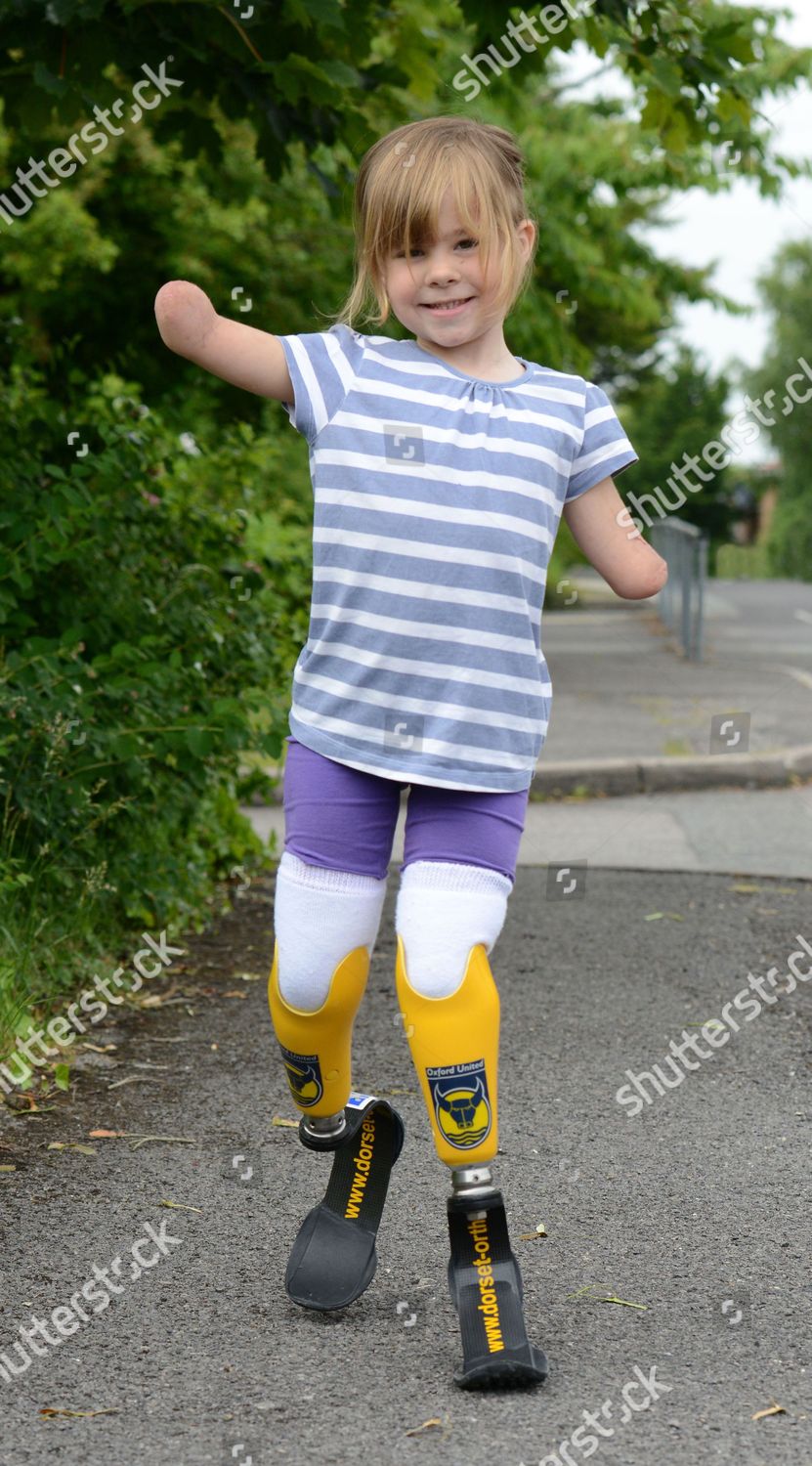 5yearold Charlotte Nott Her New Legs Editorial Stock Photo Stock