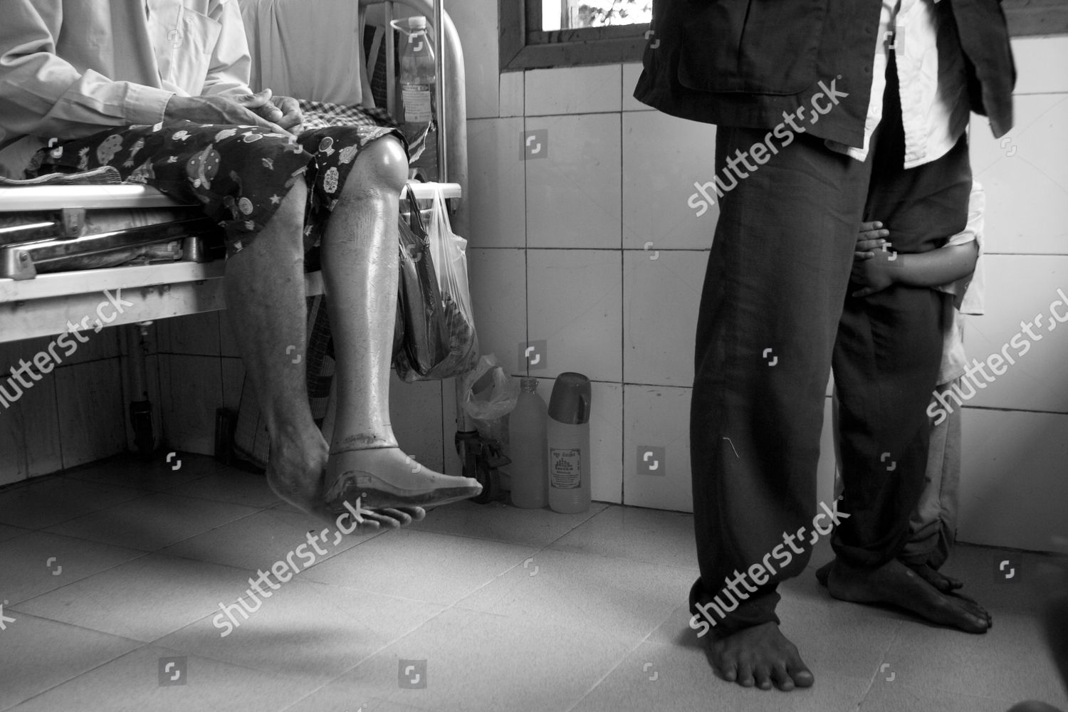 Landmine Victim Who Suffering Hiv Aids Editorial Stock Photo - Stock ...