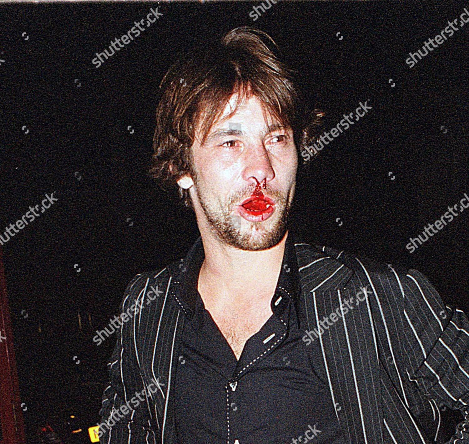 Jay Kay Bloody Nose After Being Editorial Stock Photo Stock Image Shutterstock