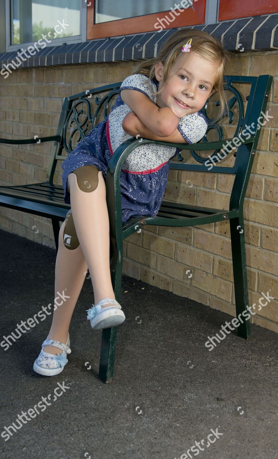 Charlotte Nott Wearing Her New Prosthetic Editorial Stock Photo - Stock ...