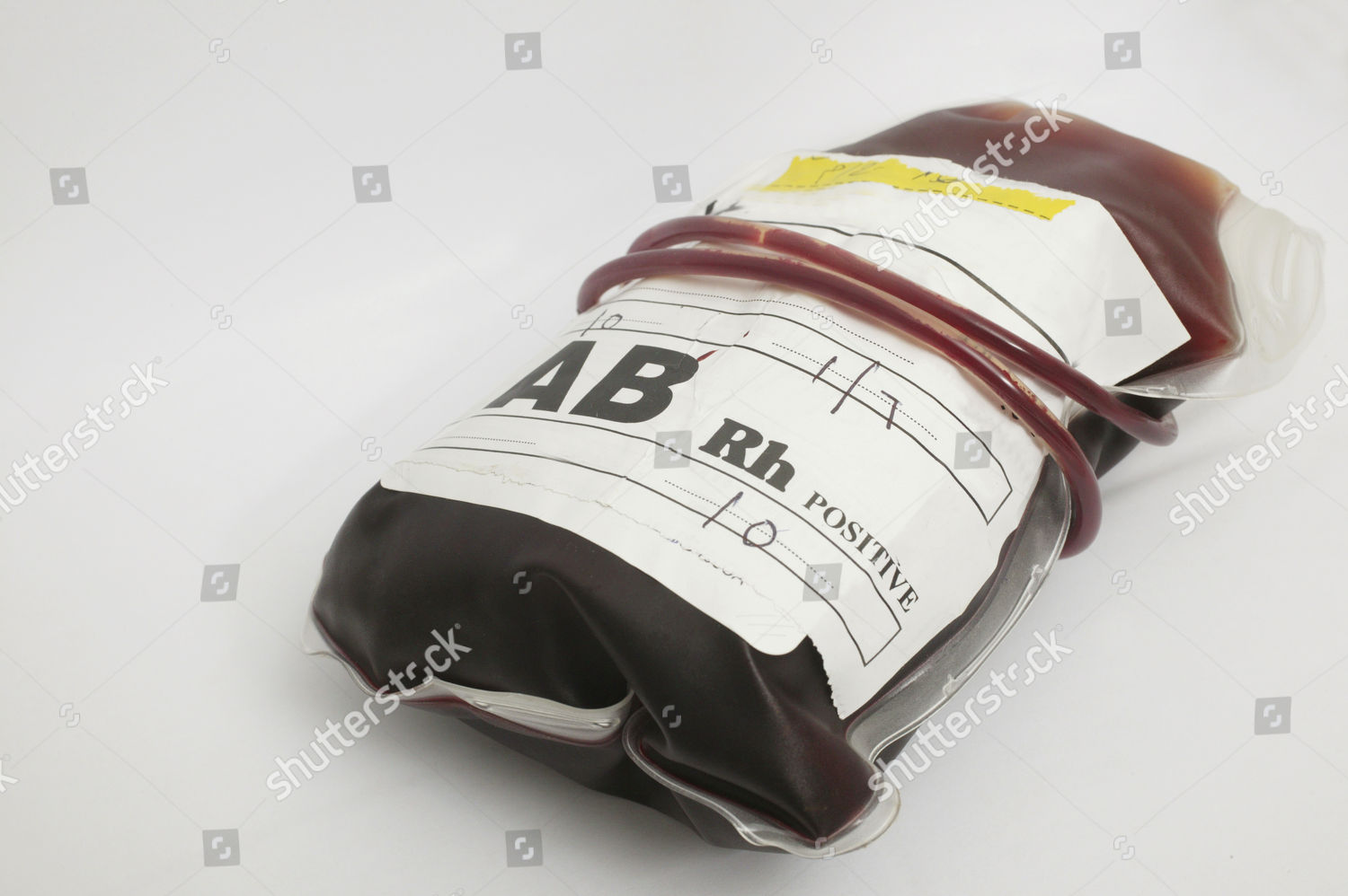 Blood Bag Containing Group Ab Positive Blood Editorial Stock Photo Stock Image Shutterstock