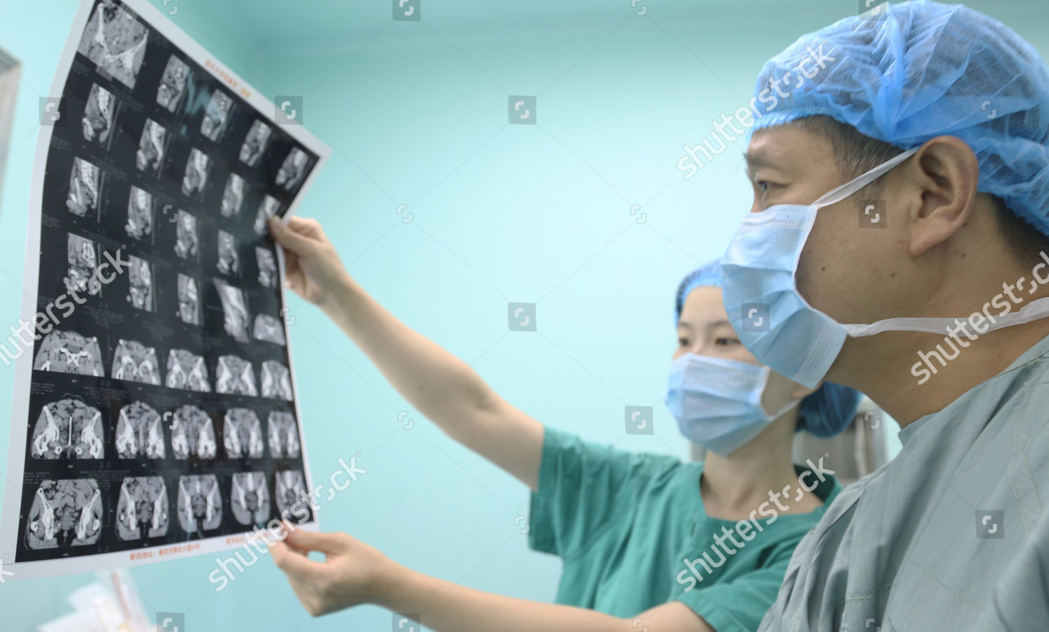 Doctors Look Xrays Editorial Stock Photo Stock Image Shutterstock