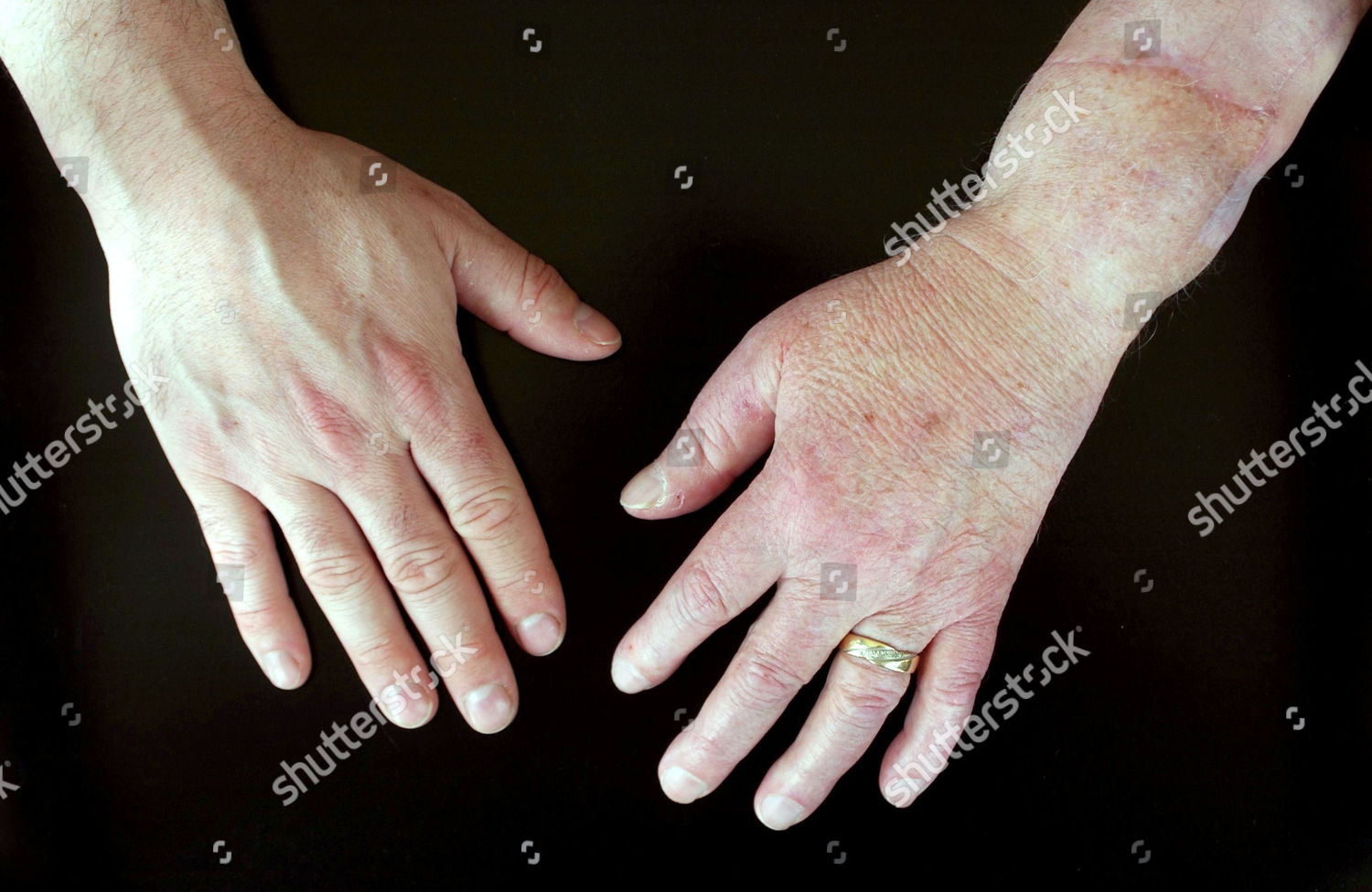 Matthew Scotts Hands Editorial Stock Photo Stock Image Shutterstock