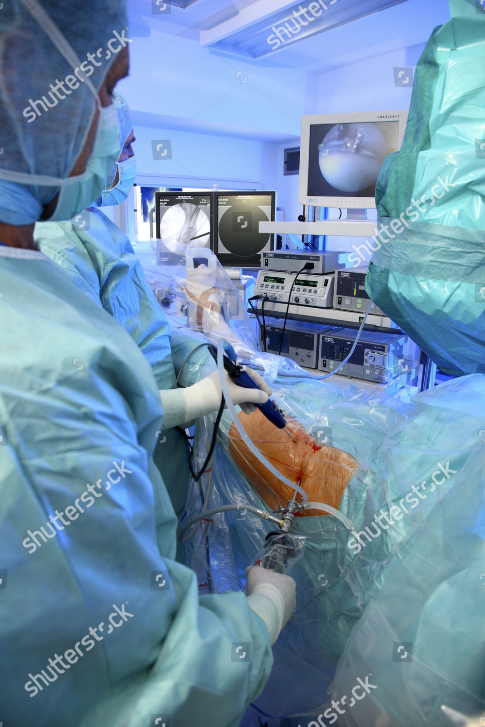 arthroscopy-hip-joint-hip-joint-endoscopy-editorial-stock-photo-stock