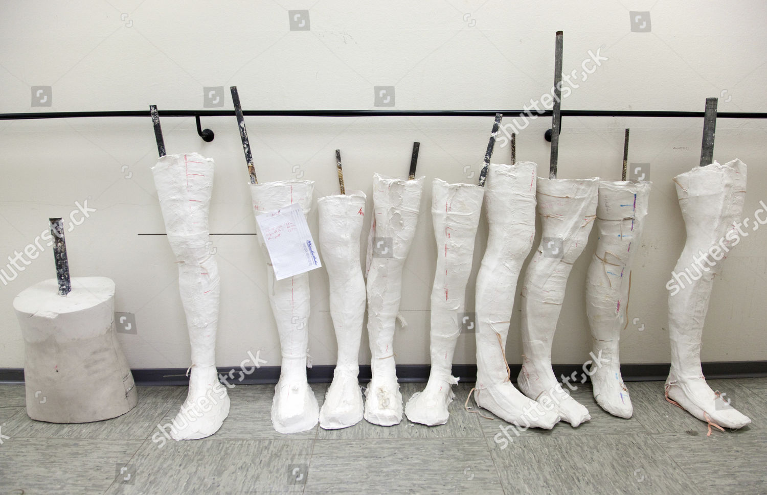 Orthopedic Technician Plaster Casts Legs Chamber Editorial Stock Photo ...