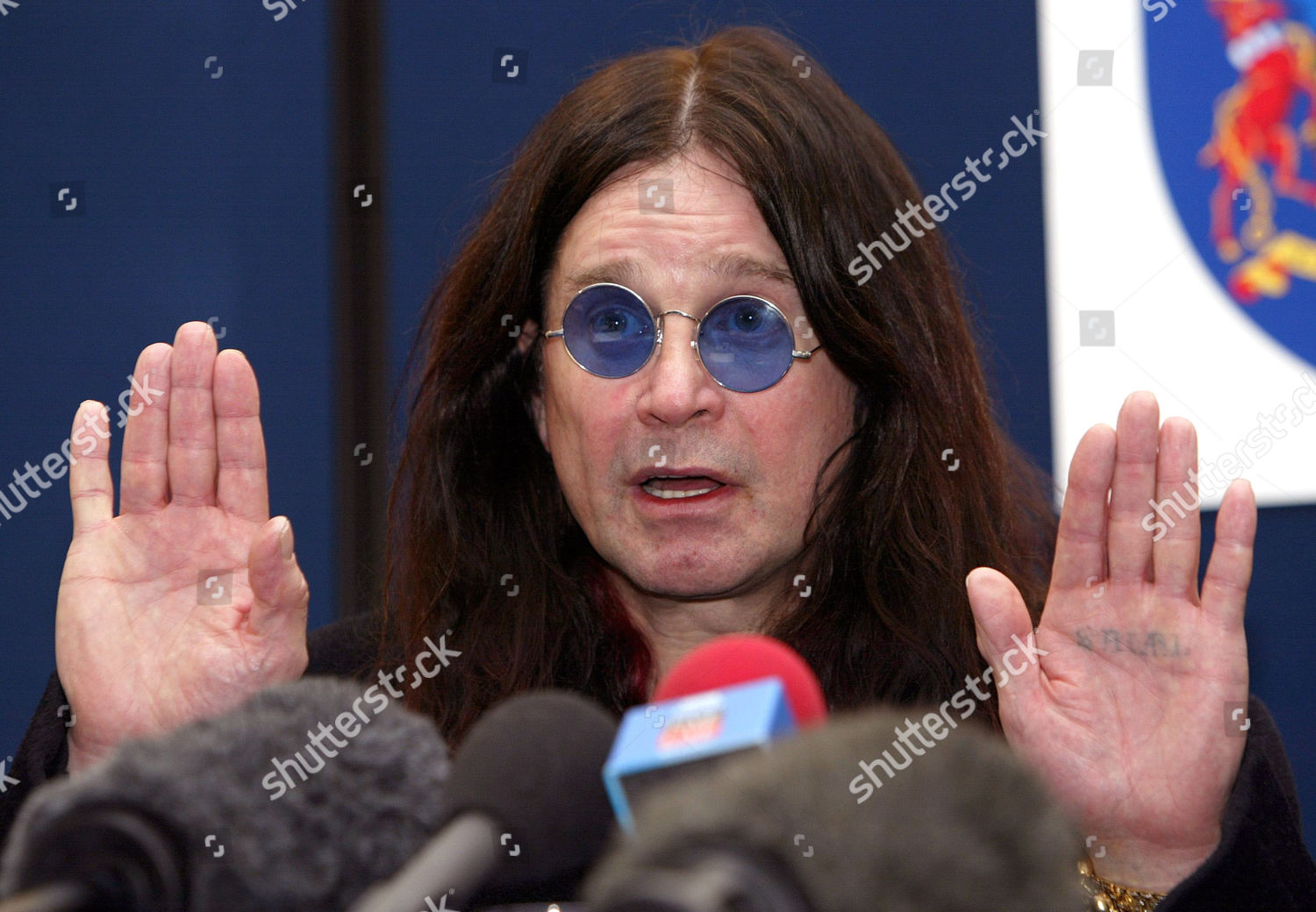 Ozzy Osbourne Has Hand Surgery and Postpones Concert