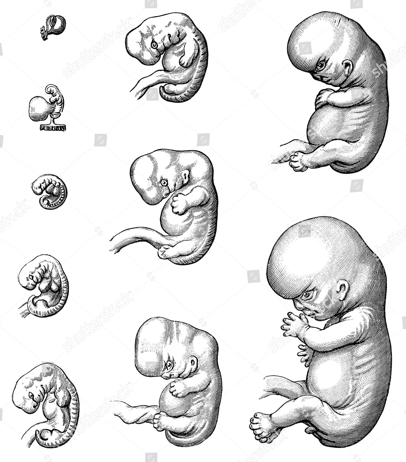 Development Embryo 9th Week 19th Century Editorial Stock Photo - Stock ...