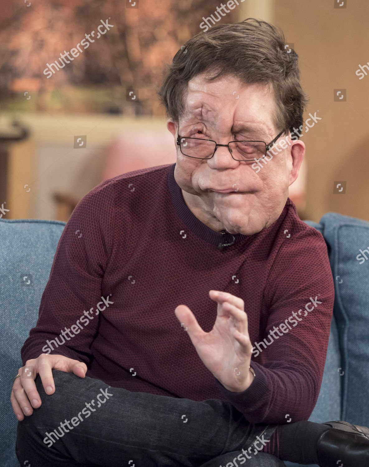 Adam Pearson Editorial Stock Photo - Stock Image | Shutterstock