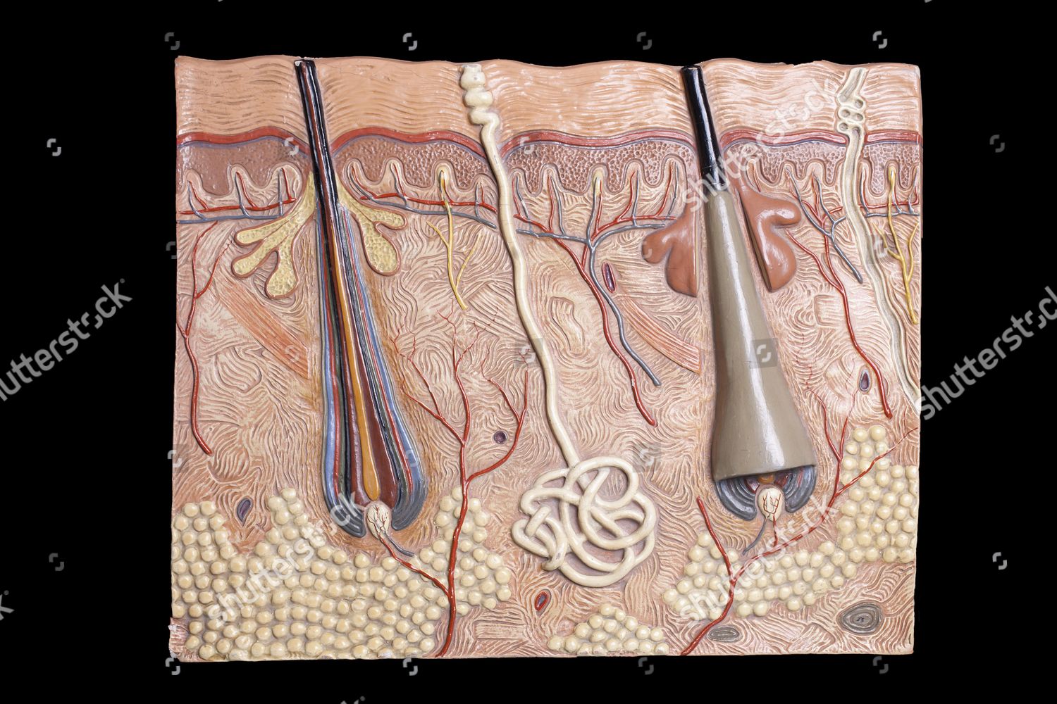 Anatomical Model Human Skin Editorial Stock Photo - Stock Image ...