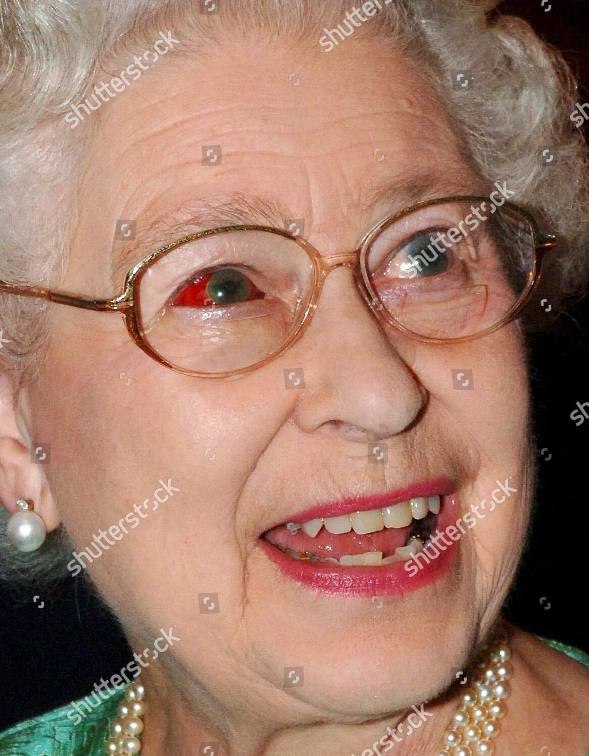 Queen Elizabeth Ii Burst Blood Vessel Editorial Stock Photo Stock