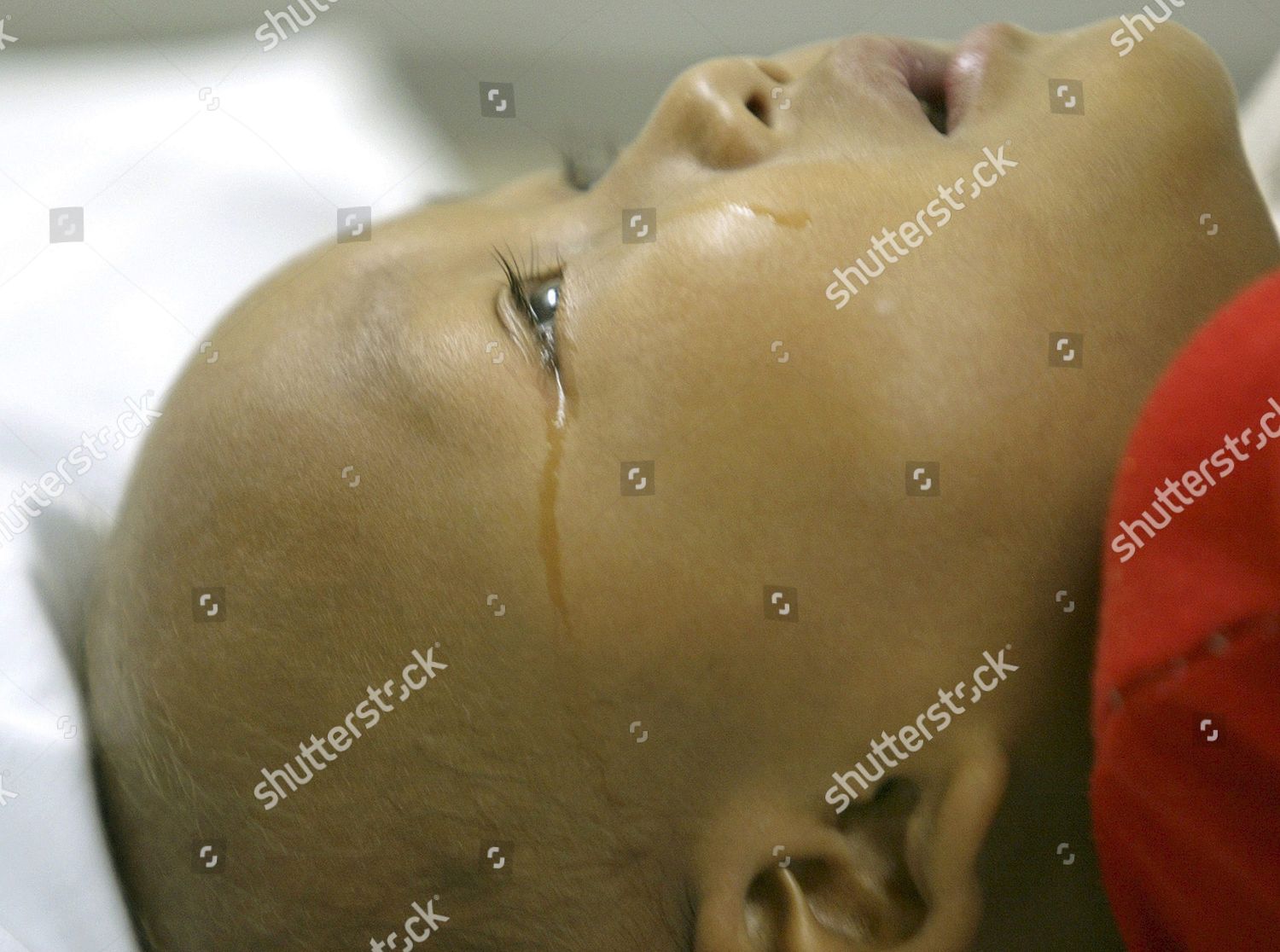 Tear Drops 4yearold Cancers Patients Eyes Editorial Stock Photo Stock